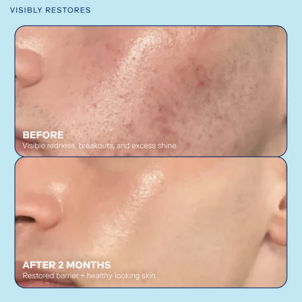Skin Barrier Restoring Gel Cream - Image 3
