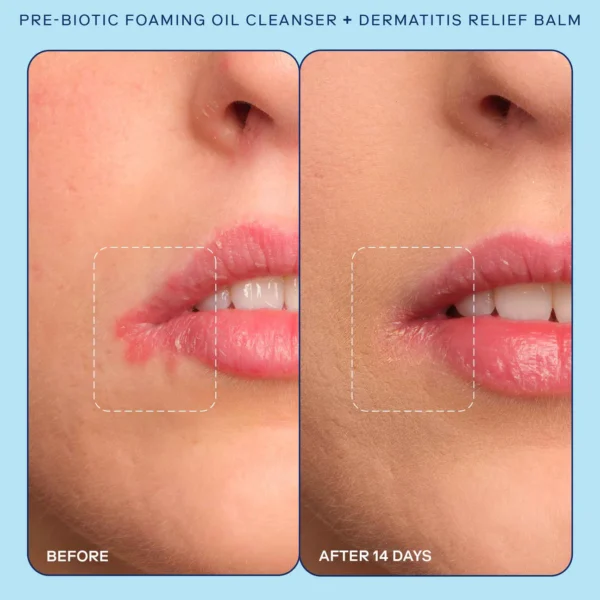 Pre-Biotic Face + Body Foaming Oil Cleanser - Image 8