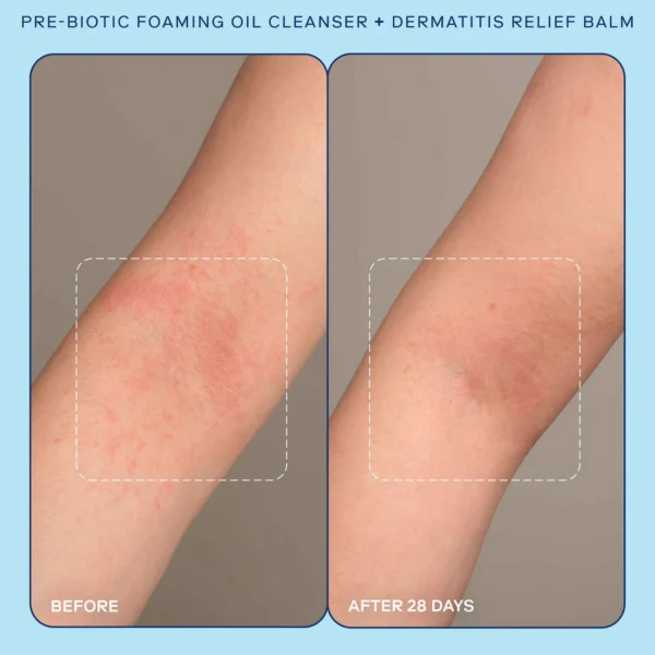 Pre-Biotic Face + Body Foaming Oil Cleanser - Image 7